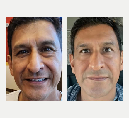 three step facelift skincare for men