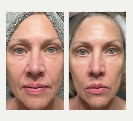 3 Step Facelift skincare reviews